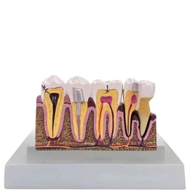 Fogászati Oktatási Anatómiai Fogmodell Keresztmetszettel és Kivehető Foggal 27614